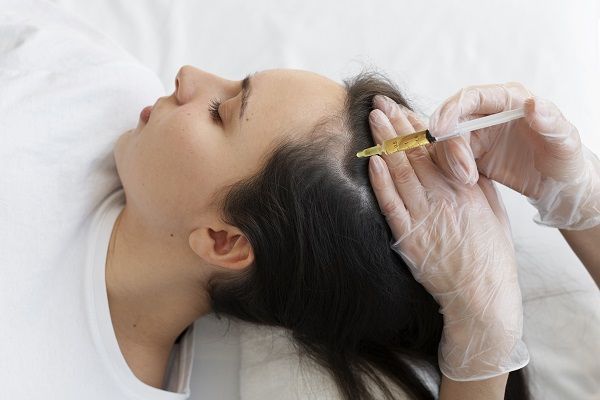 donna che si sottopone ad una iniezione sul cuoio capelluto. botox per capelli