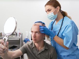 trapianto capelli italia