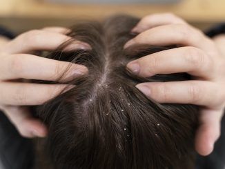 capelli con forfora