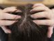 capelli con forfora