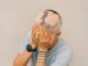 Alopecia areata reale in una bambina giovane Testa calva in una persona Alopecia diffusa