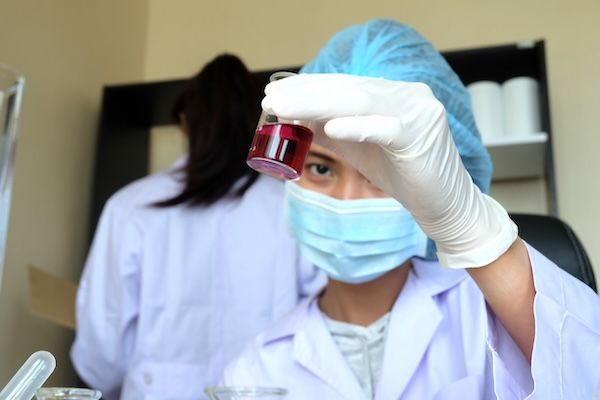tecnico di laboratorio valuta capacità di coagulazione del sangue