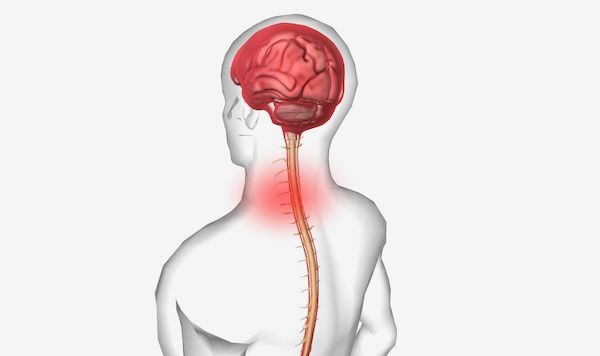 grafico di una spina dorsale e del cervello per mostrare che La meningite è l'infiammazione delle meningi.