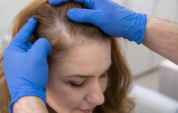 Trapianto capelli femminile