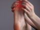 Dolore alle dita, lesione, artrite, alluce valgo, calli, concetto