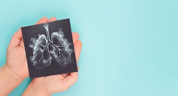Polmone con fumo, radiografia dell'organo, giornata mondiale senza tabacco, dipendenza non salutare, salute medica, rischi di bronchite senza febbre