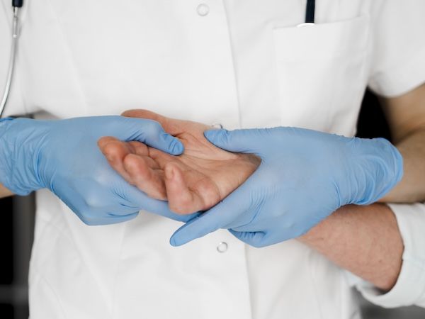 ortopedico dottore che esamina il palmo di una mano con frattura dello scafoide non curata