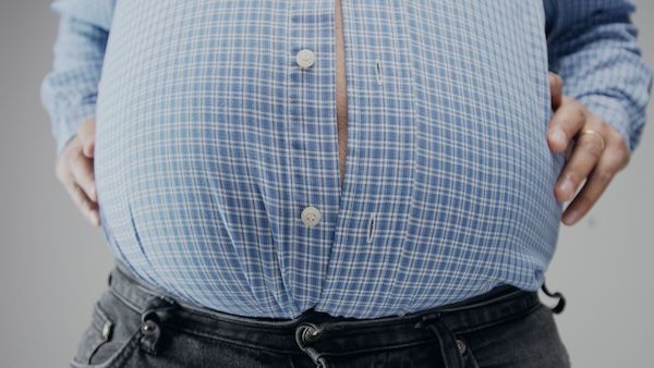 obesità addominale uno dei diversi tipi di obesità