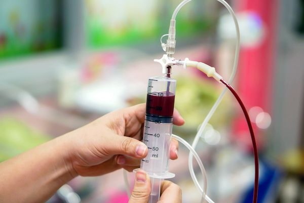 Le mani dell'infermiera stanno sistemando la siringa per estrarre sangue dalla sacca di sangue per preparare dialisi e emodialisi