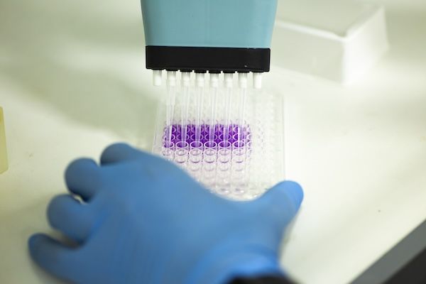 Coltura cellulare nella medicina: medico e laboratorio di coltura cellulare per la ricerca scientifica studiando la terapia genica per i tumori