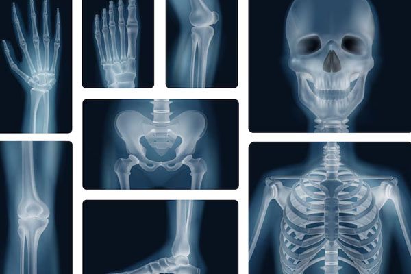 Immagini-radiografiche-delle-ossa
