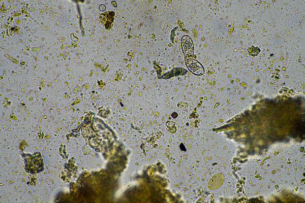 microrganismi-microscopici-visti-al-microscopio