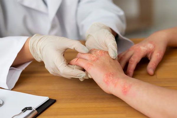 Il medico controlla le mani di un paziente malato
