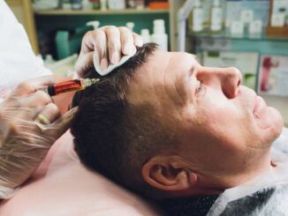 trapianto capelli 50 60 anni