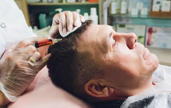 trapianto capelli 50 60 anni