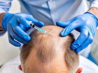 infiammazione trapianto capelli