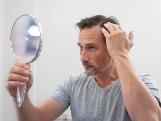capelli trapiantati non cadono