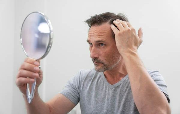 capelli trapiantati non cadono