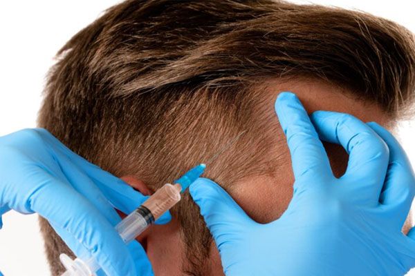 Primo piano della mano di un medico con una siringa e di un uomo che riceve un'iniezione - trapianto di capelli Turchia 