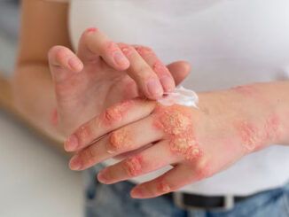 Scabbia cos'è sintomi e trattamenti