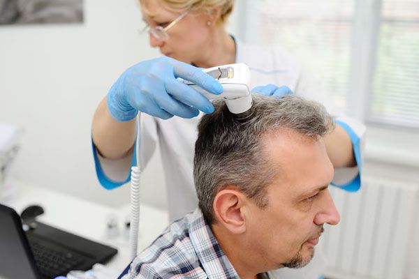 Uomo che cura i suoi problemi di calvizie - miglior trapianto capelli Italia
