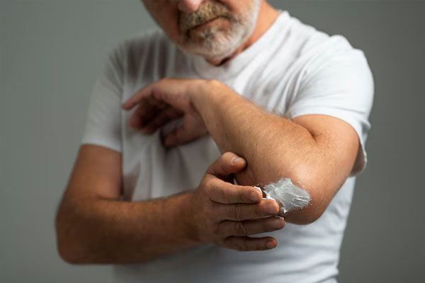 uomo anziano che applica la crema per la pelle