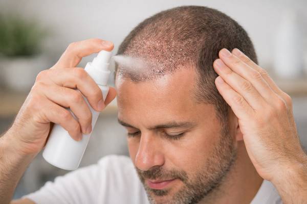 Persona che applica delicatamente uno spray lenitivo sulla cute dopo l'intervento