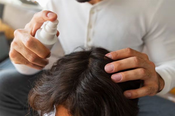 Padre che applica un trattamento per capelli al suo bambino - miglior trapianto capelli Italia