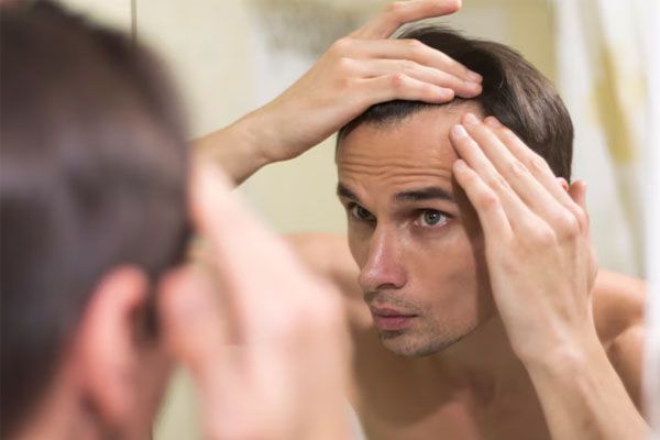 primo piano uomo che prepara i capelli - trapianto capelli Italia