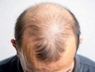 scegliere una clinica locale o internazionale