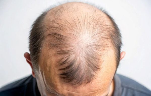 scegliere una clinica locale o internazionale