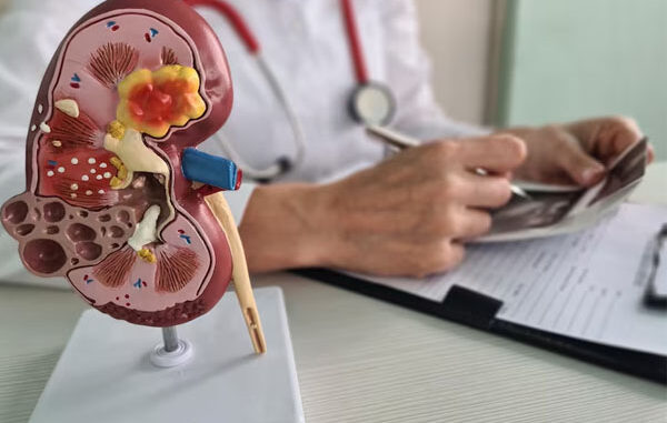 Dieta per insufficienza renale