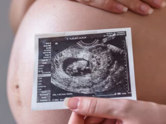 Immagine ecografica della pancia di una donna incinta