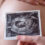 Immagine ecografica della pancia di una donna incinta