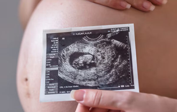 Immagine ecografica della pancia di una donna incinta