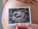 Immagine ecografica della pancia di una donna incinta