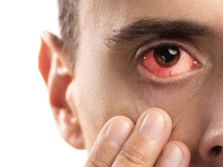 Occhio rosso_ cause più comuni e quando rivolgersi al medico