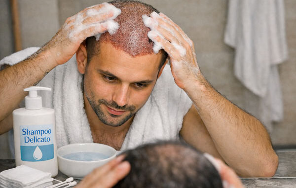 Trattamento medico dopo un trapianto di capelli