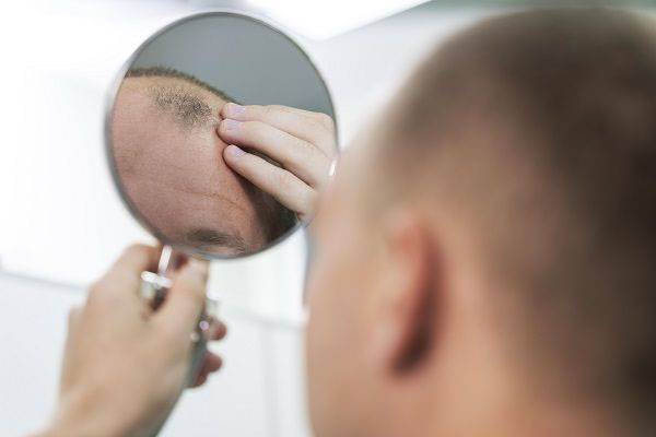 Uomo calvo di spalle alla telecamera, che si guarda allo specchioUomo calvo di spalle alla telecamera, che si guarda allo specchio