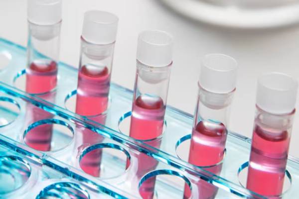 Provette da laboratorio con sequenziamento del DNA per la diagnosi genetica delle atassie