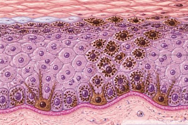 Sezione della cute che mostra le alterazioni epidermiche e l'accumulo di pigmento causato dal difetto genico
