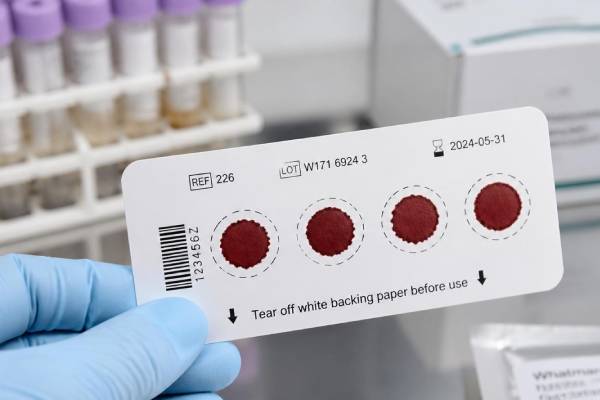Carta assorbente medica per lo screening neonatale e diagnostico con gocce di sangue essiccate