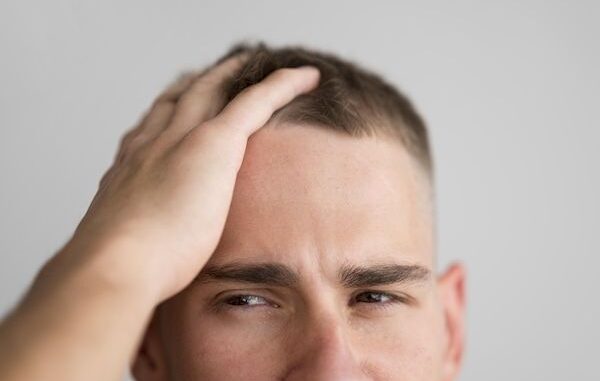 Il trapianto di capelli fa al caso vostro