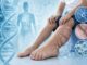 Sindrome di Proteus