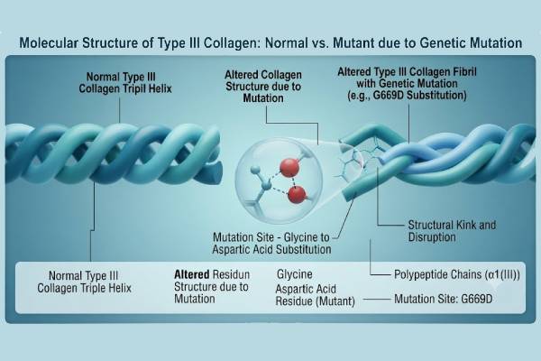 Illustrazione scientifica tridimensionale della tripla elica di collagene tipo III alterata da mutazione genetica