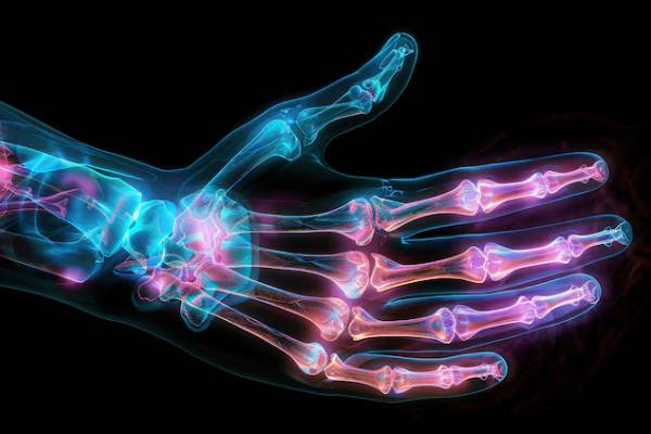 Radiografie che mostrano ossa in posizioni insolite