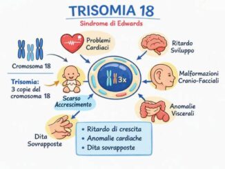 Sindrome di Edwards